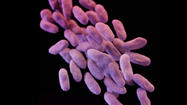 Treatment underway of 'superbug' case reported at USC-Verdugo Hills Hospital